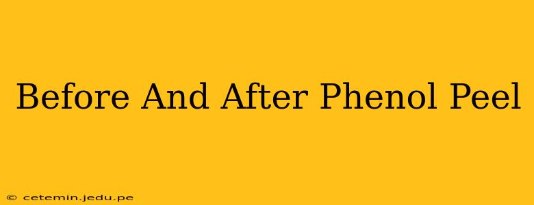 Before And After Phenol Peel