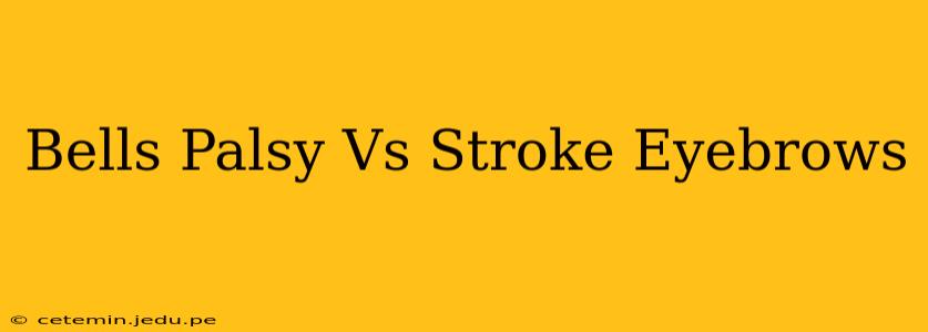 Bells Palsy Vs Stroke Eyebrows