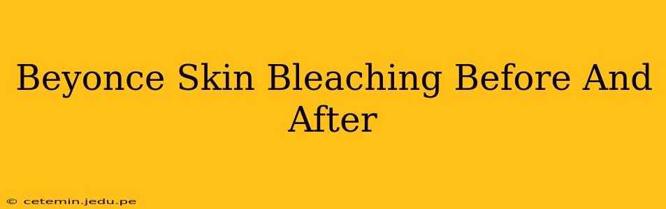 Beyonce Skin Bleaching Before And After