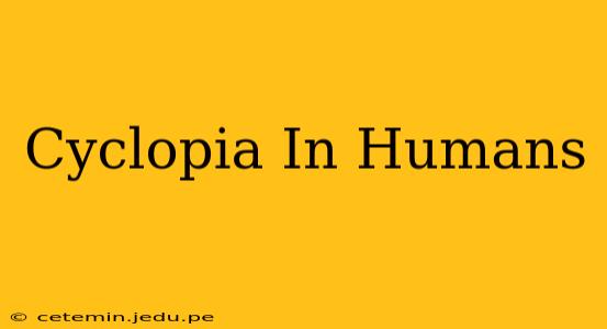 Cyclopia In Humans