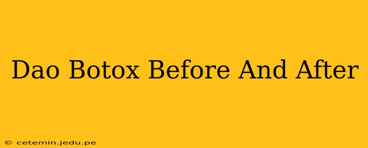 Dao Botox Before And After