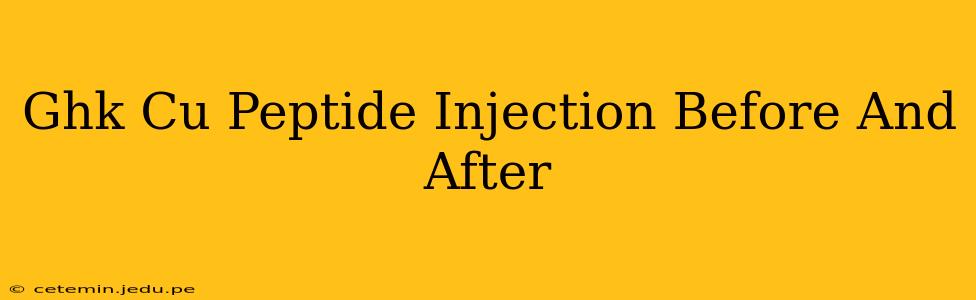 Ghk Cu Peptide Injection Before And After
