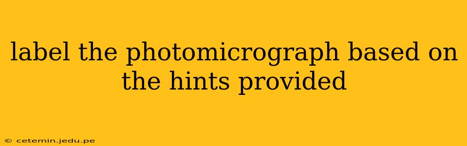 label the photomicrograph based on the hints provided