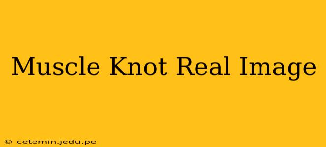 Muscle Knot Real Image