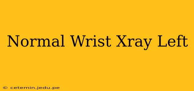 Normal Wrist Xray Left