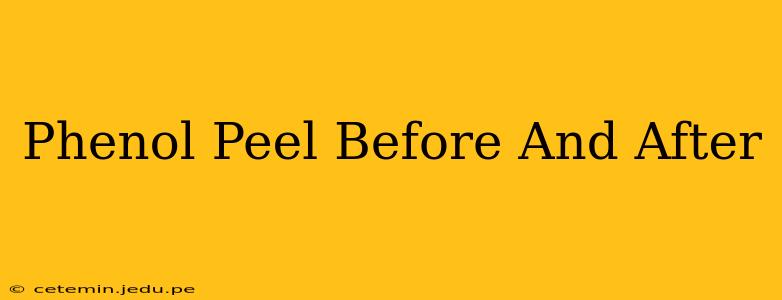 Phenol Peel Before And After