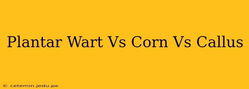 Plantar Wart Vs Corn Vs Callus