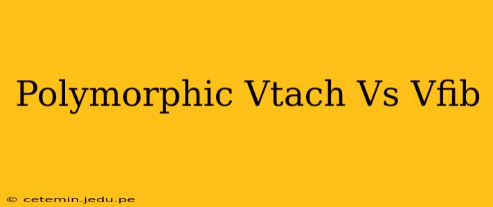 Polymorphic Vtach Vs Vfib