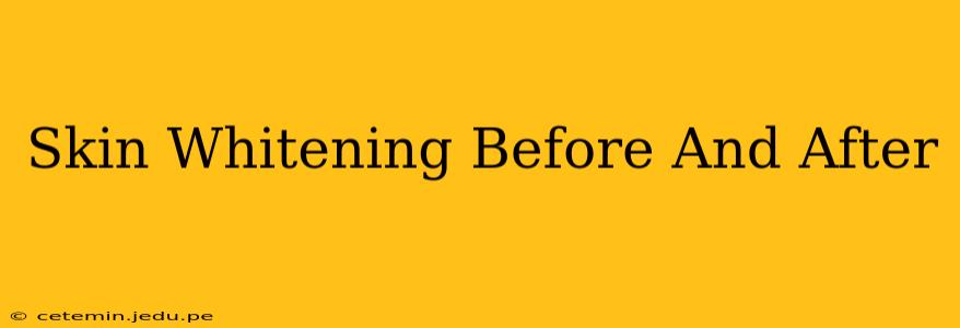 Skin Whitening Before And After
