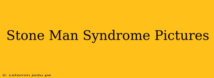 Stone Man Syndrome Pictures