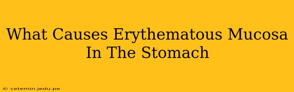 What Causes Erythematous Mucosa In The Stomach