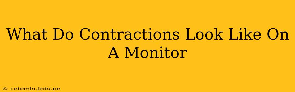 What Do Contractions Look Like On A Monitor