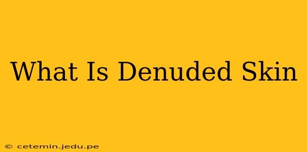 What Is Denuded Skin